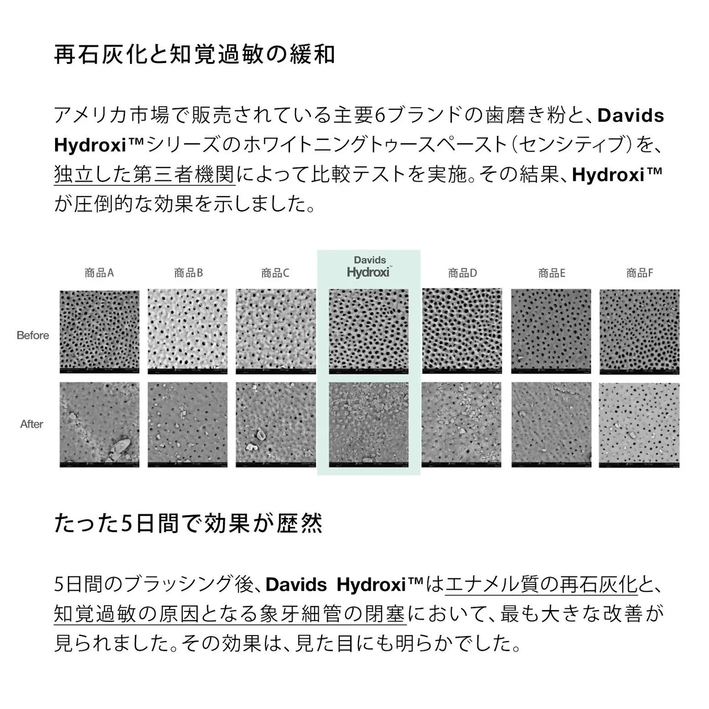 Hydroxi™ ホワイトニングトゥースペースト（マイルドミント）